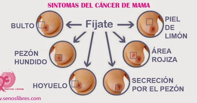Cinco estilos a la hora de ligar